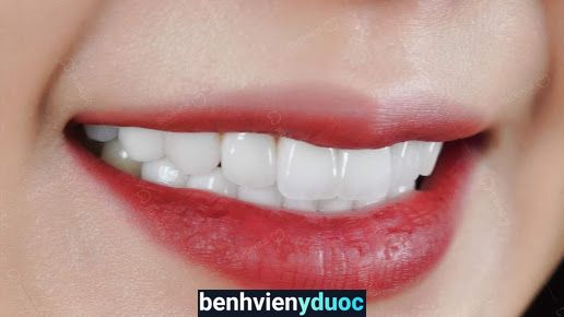 Be Dental - Nha Khoa Uy tín 15 năm, Chuyên Làm Răng Sứ thẩm mỹ, Trồng răng implant, Nhổ răng khôn tại Thành phố Vinh, Nghệ An Vinh Nghệ An