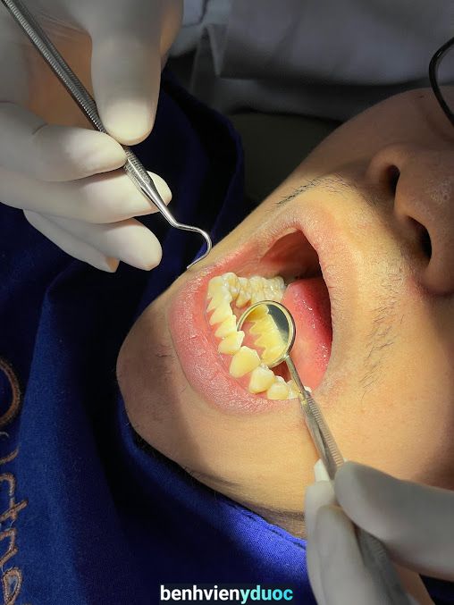 Be Dental - Nha Khoa Uy tín 15 năm, Chuyên Làm Răng Sứ thẩm mỹ, Trồng răng implant, Nhổ răng khôn tại Thành phố Vinh, Nghệ An Vinh Nghệ An