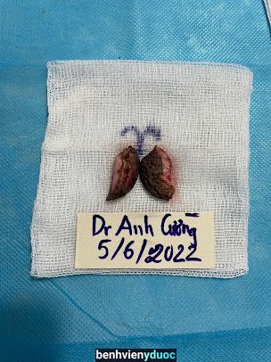 Bệnh Trĩ - Nam khoa - Phòng Khám Tuệ Đức Dr Cường Ngoại Khoa -THTM Việt Trì Phú Thọ