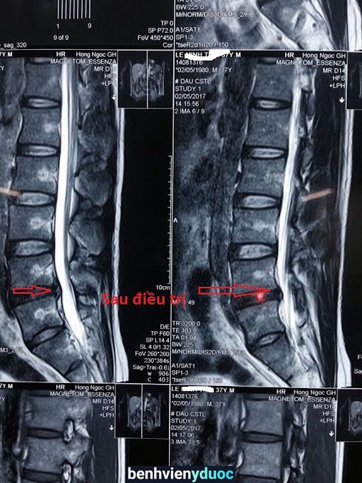 Bs Hào: Vật lý trị liệu Phục hồi chức năng Hoài Đức Hà Nội