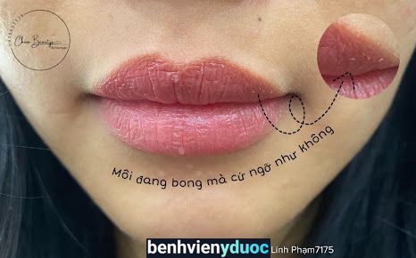 Chinn Beauty & Spa Thủ Đức Hồ Chí Minh