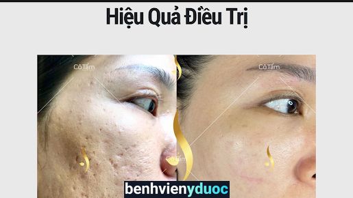 Cô Tấm Spa - Chuyên Trị Rổ, Nám, Mụn uy tín & lâu năm Bình Thạnh Hồ Chí Minh