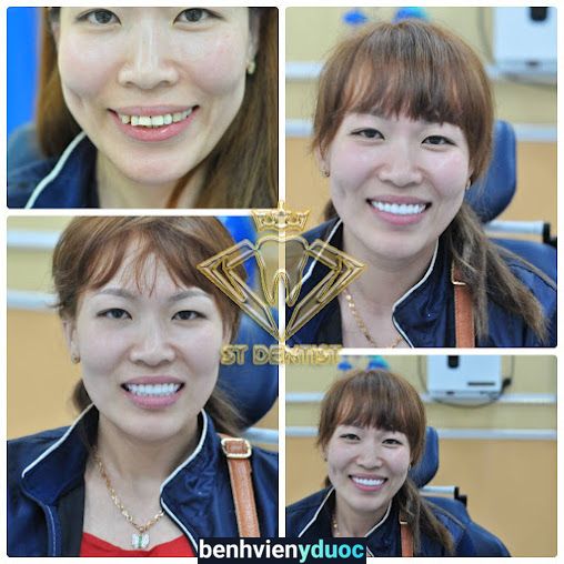 Hệ Thống Nha Khoa Thẩm Mỹ ST Dentist - CN Quy Nhon Quy Nhơn Bình Định