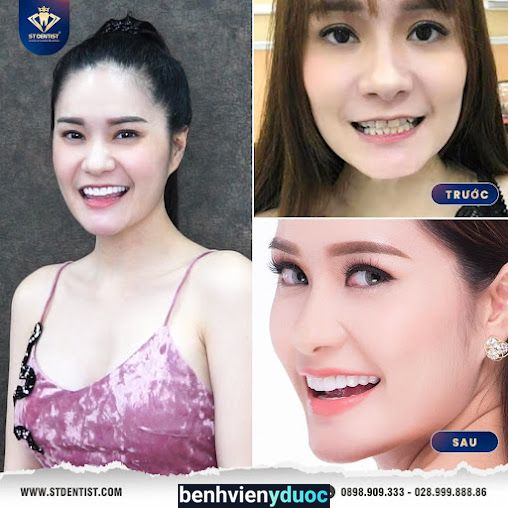 Hệ Thống Nha Khoa Thẩm Mỹ ST Dentist - CN Quy Nhon Quy Nhơn Bình Định