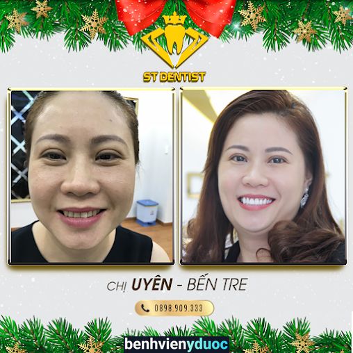 Hệ Thống Nha Khoa Thẩm Mỹ ST Dentist - CN Quy Nhon Quy Nhơn Bình Định