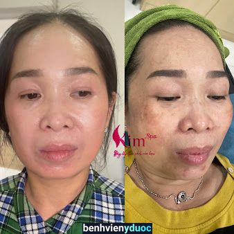 Kim Spa Quận Bình Tân