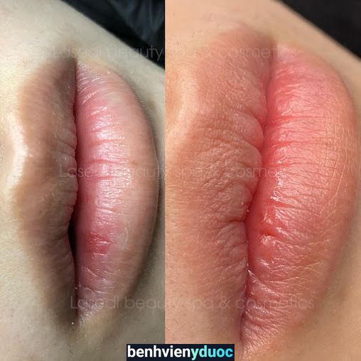 Lasedi Beauty Spa & Clinic Bảo Lộc Lâm Đồng