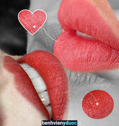 LINH HY BEAUTY CENTER | PHUN XĂM BIÊN HOÀ | TIÊM FILLER BIÊN HOÀ Biên Hòa Đồng Nai