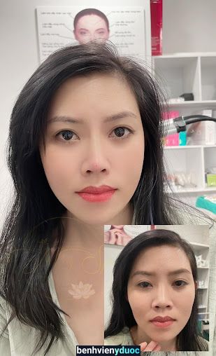 Mây Beauty Clinic | Spa Chăm Da Quận 8 | Phun Xăm Thẩm Mỹ Quận 8 8 Hồ Chí Minh