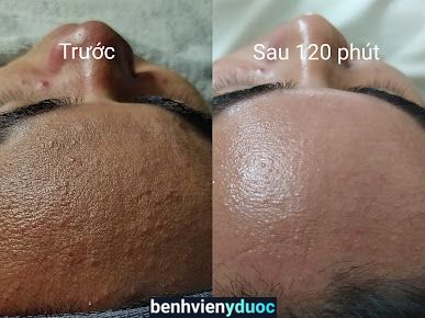 Minimal Beauty & Spa Hà Đông Hà Nội