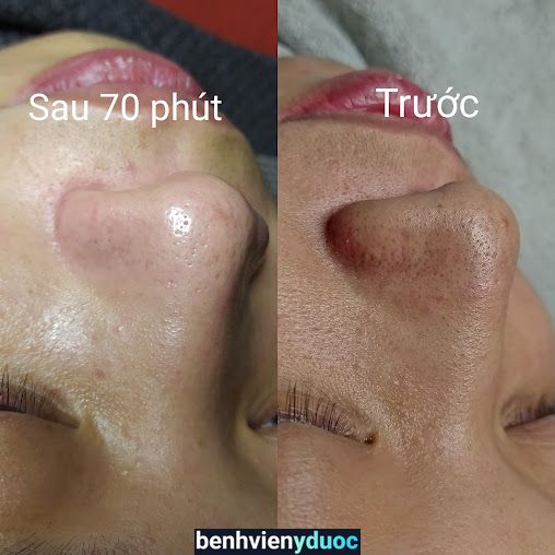 Minimal Beauty & Spa Hà Đông Hà Nội