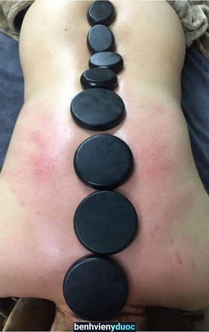 Mộc Beauty Spa Mình Thu - Chăm Sóc Sức Khỏe Và Làm Đẹp Hà Đông Hà Nội