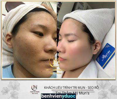 Mun's Spa - Thẩm Mỹ Viện Mun's Đông Anh Hà Nội