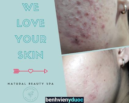 Natural Beauty Spa Phú Nhuận Hồ Chí Minh