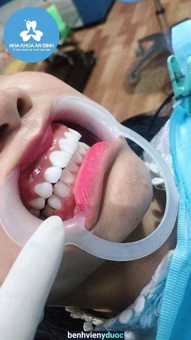NHA KHOA - AN BINH - SAM SUNG - BẮC NINH 🦷
