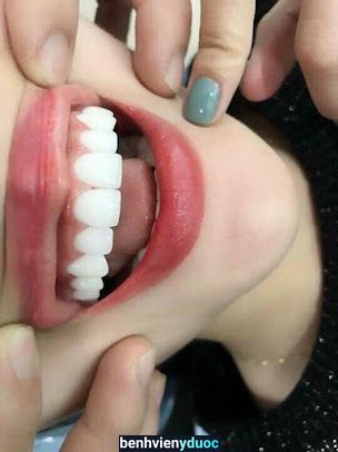 Nha Khoa An Du Hà Đông Hà Nội