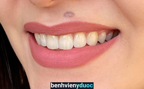 Nha Khoa Bao An Dental