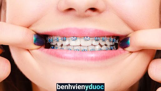 Nha Khoa Hi.Dent (Hi.Dent Dental & Implant Center) Thủ Dầu Một Bình Dương