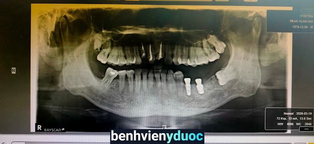 Nha Khoa Hi.Dent (Hi.Dent Dental & Implant Center) Thủ Dầu Một Bình Dương