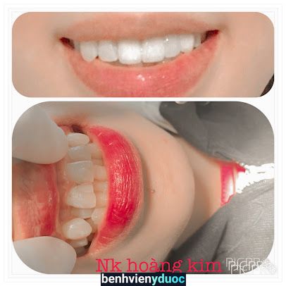 Nha Khoa Hoàng Kim Thuận An Bình Dương