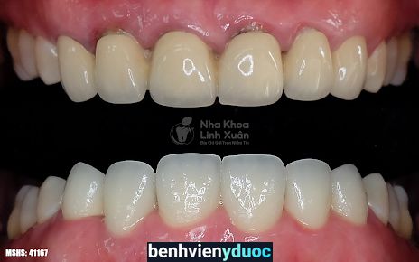 Nha Khoa Linh Xuân - CN Dĩ An Dĩ An Bình Dương