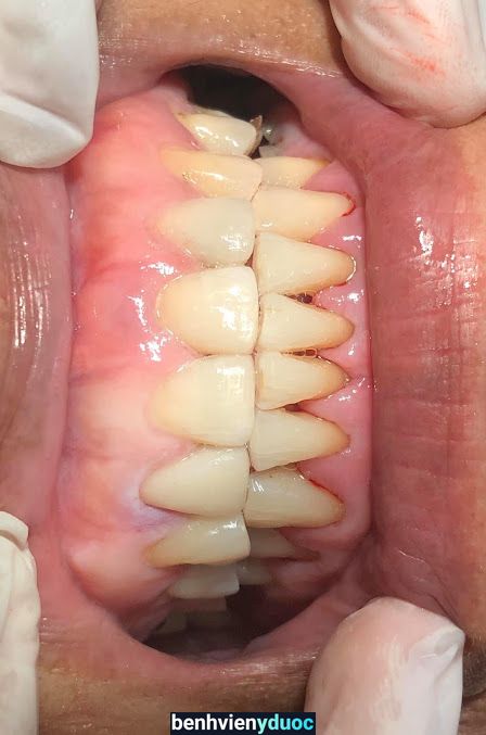 Nha Khoa Ngọc Anh Thuận An Bình Dương