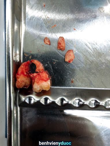 Nha khoa Ngọc- Nhổ Răng Khôn Không Đau, Giá Rẻ, Làm Trắng Răng, Nắn Chỉnh Răng Uy Tín Tại Thái Bình Thái Bình Thái Bình