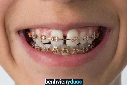 NHA KHOA NGỌC TÂN YÊN DŨNG Yên Dũng Bắc Giang