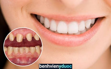 NHA KHOA NGỌC TÂN YÊN DŨNG Yên Dũng Bắc Giang