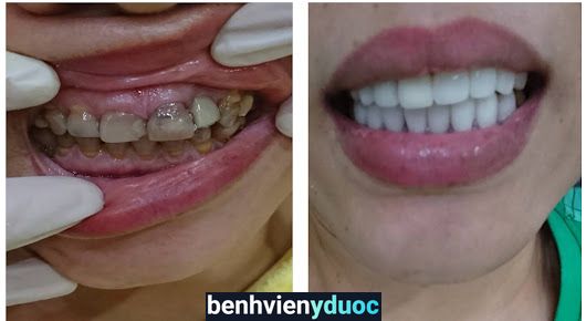 Nha Khoa Nhật Tảo - Bs Quách Thị Quỳnh Chi 10 Hồ Chí Minh