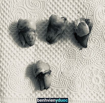 Nha Khoa Phú Hương Diễn Châu Nghệ An