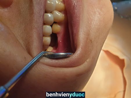 Nha Khoa QUANG LAN Đô Lương Nghệ An