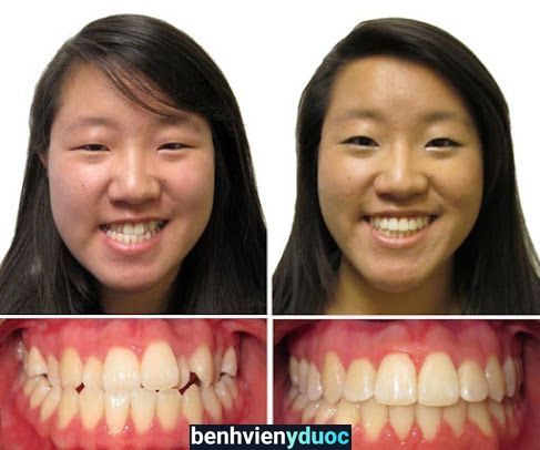 Nha Khoa Quốc Tế Á Châu Hoàn Kiếm Hà Nội