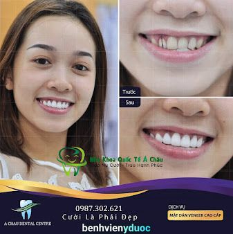 Nha Khoa Quốc Tế Á Châu Hoàn Kiếm Hà Nội
