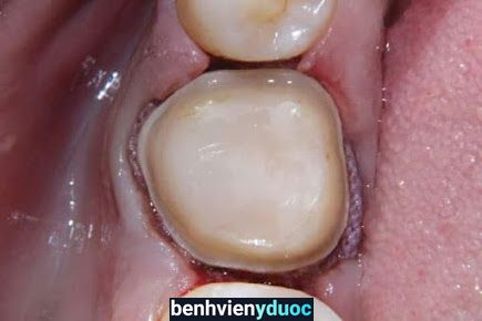Nha khoa Tâm An. Tâm An Dental Tourism.