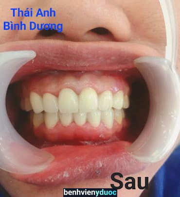 Nha Khoa Thái Anh Dĩ An Bình Dương
