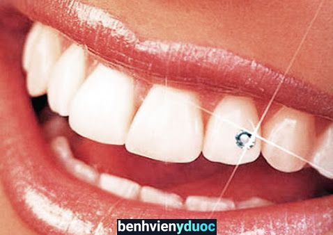 Nha Khoa Thẩm Mỹ Việt Nha Thủ Dầu Một Bình Dương