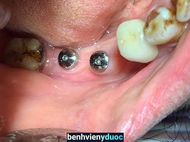 Nha khoa Thu Thiết Quỳnh Phụ Thái Bình