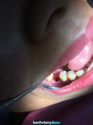 Nha khoa Thu Thiết Quỳnh Phụ Thái Bình