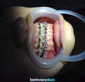 Nha khoa Thuận Phát Quy Nhơn Bình Định