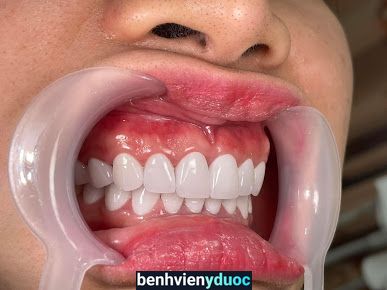 Nha Khoa uy tín Quốc tế sài gòn Bồng sơn Hoài Nhơn Bình Định