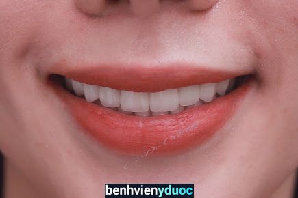 Nha Khoa uy tín Quốc tế sài gòn Bồng sơn Hoài Nhơn Bình Định
