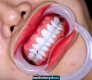 Nha Khoa uy tín Quốc tế sài gòn Bồng sơn Hoài Nhơn Bình Định