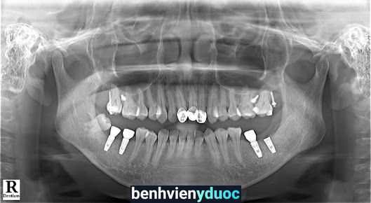 Nha Khoa Vân Anh Cơ Sở Từ Sơn Từ Sơn Bắc Ninh