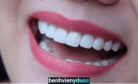 Nha Khoa Việt Anh Tân Kỳ Nghệ An