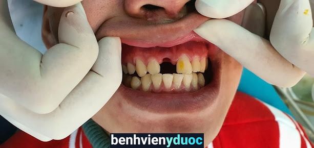 Nha khoa Việt Đức Đan Phượng Hà Nội