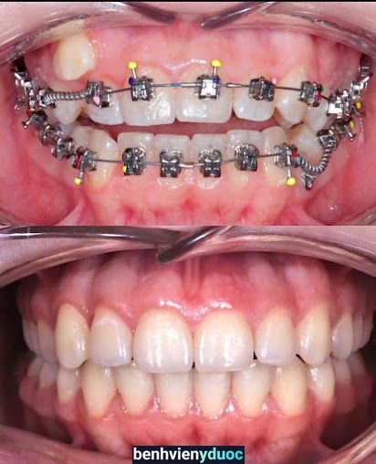 Nha Khoa Việt Đức Nhơn Trạch Đồng Nai