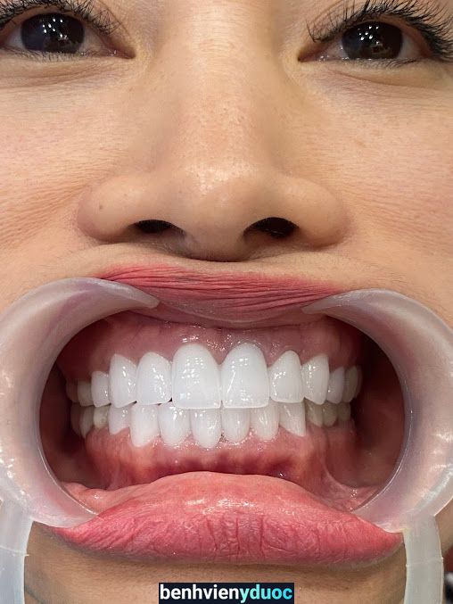 Nha Khoa Việt Mỹ Dental 7 Hồ Chí Minh
