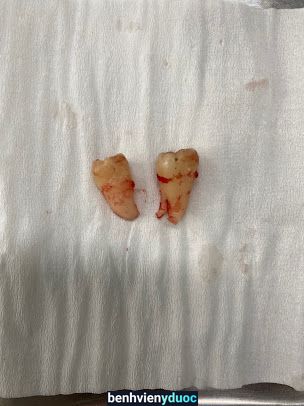 NHA KHOA VIỆT PHÁP Việt Yên Bắc Giang