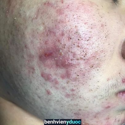 Nhật Băng Treatment & Spa Gò Vấp Hồ Chí Minh